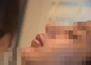 Merdiven altı işletmede yaptırdığı dolgu yüzünden dudağından oluyordu