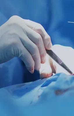 Türk firma yaptı dünya bu cihazı konuşuyor
