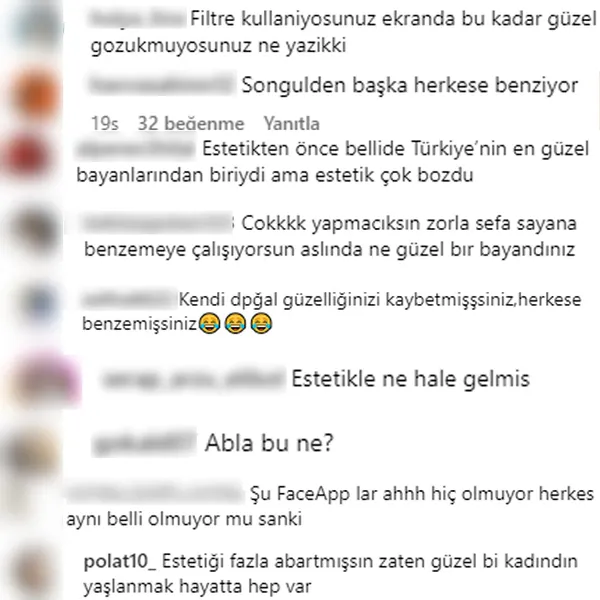 songul-karli-elini-gogsune-koyup-paylasti-50-yasindaki-sarkici-filtreyi-abartinca-ortalik-karisti-ekranda-boyl-1699782569068.jpg Songül Karlı elini göğsüne koyup paylaştı! 50 yaşındaki şarkıcı filtreyi abartınca ortalık karıştı: Ekranda böyle güzel değilsiniz!-9