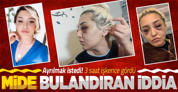 Ayrılmak isteyen kız arkadaşı Gamze Tümtürk'ü 3 saat boyunca darbetti! E.Y. hakkında cinsel saldırı suç duyurusu