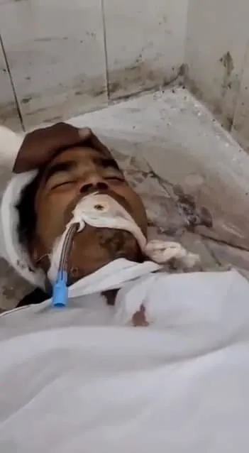 morgda-canlandi-kan-donduran-anlar-kamerada-iste-inanilmaz-anlar-1637758882402.jpg Morgda canlandı! Kan donduran anlar kamerada.... İşte inanılmaz anlar-6