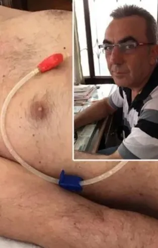 2.5 yıldır bitkisel hayatta! Tutuklandı!