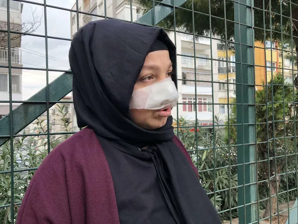 yuruyus-yaparken-pitbull-saldirisina-ugradi-burnu-parcalandi-1638539578194.jpg Yürüyüş yaparken pitbull saldırısına uğradı! Burnu parçalandı-9