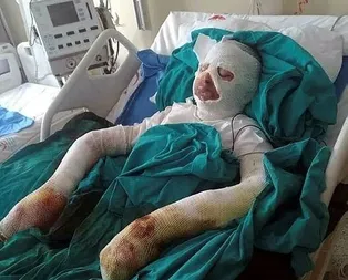 Kendini ’bit’irdi