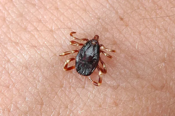 bu-hastalik-koronavirusten-daha-olumcul-vucudun-cesitli-bolgelerinde-1591385938560.jpg Bu hastalık koronavirüsten daha ölümcül! Vücudun çeşitli bölgelerinde...-3