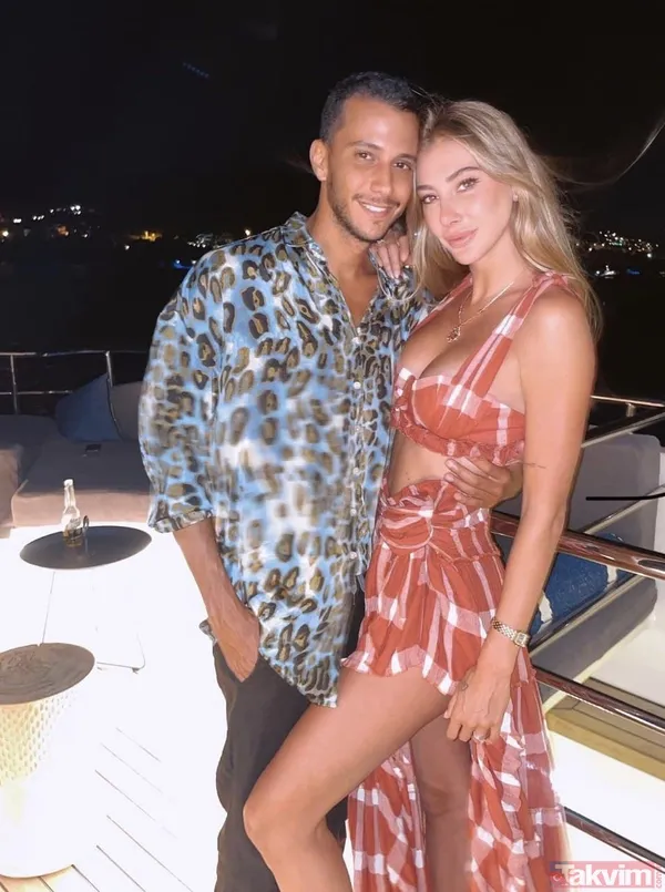 Acun Ilıcalı'nın yüzü gözü morluk içinde gören darp edildi sanıyor ama işin aslı başka! Estetik mi derken... - 50