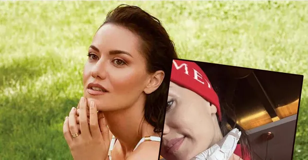 Sosyal medyada duyurdu: Burak Özçivit'in eşi Fahriye Evcen kaza geçirdi!