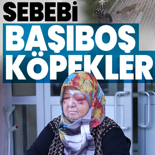 Edirnede başıboş köpek dehşeti kamerada: Yaşlı kadının yüzü gözü tanınmaz halde