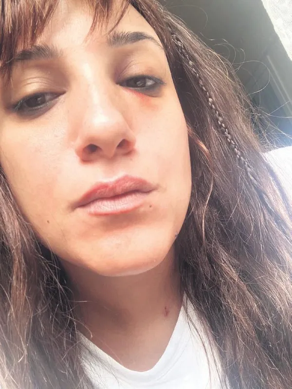 1694207240626.jpeg Taksim Eğitim ve Araştırma Hastanesi'nde ortalık karıştı! Epilepsi geçiren kadına kelepçe şoku...-3