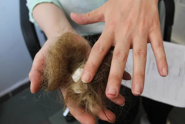 Kadın hasta hemşireyi darp etti! Önce küfürler savurdu sonra saçlarını yoldu-2