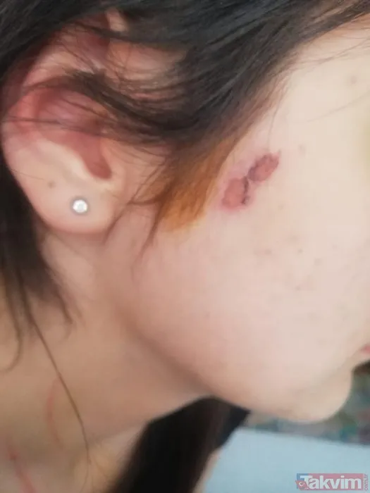 Konya'da iki kadın tarafından kaçırılıp işkence edilen Demet A dehşet anlarını anlattı! 'Evden çıkamayacağım sandım' - 25