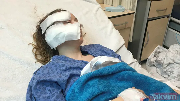 Genç kadına falçatalı dehşet! Boşanmak isteyen Ukraynalı eşi Anna Butim'in yüzünü parçaladı! - 11