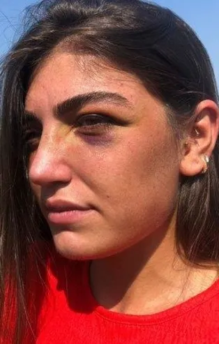 Eski mankene gece kulübünde öldüresiye dayak! Kan donduran görüntü: Gizem Akbaş'a şiddet anı kamerada