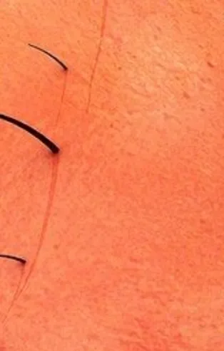 Rüyada kıl görmek ne anlama gelir?