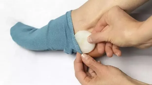 Soğanı ayağınıza koyun ve uyuyun! Bebeklerde ve çocuklarda en etkili yöntem! Sabah uyandığınızda...