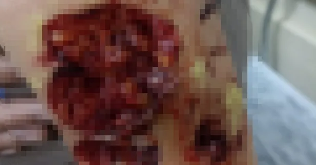 Son dakika: Şanlıurfa’da başıboş köpek dehşeti! 12 yaşındaki çocuğu parçaladılar!