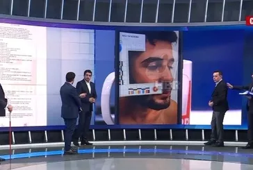 İşte Narin Güran'in abisi Enes Güran'ın kolundaki ısırık izi!