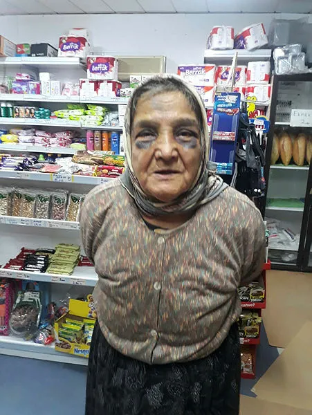 Kocaeli'de kan donduran olay! 73 yaşındaki eşini demir çubukla bu hale getirdi!-2