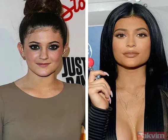 Bella Hadid ve Şeyma Subaşı'nın idolü Hailey Baldwin'in estetik açıklaması olay: Yüzüme asla dokunmadım! - 20