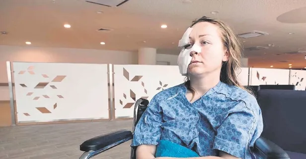 Ukraynalı eşinin yüzünü falçatayla kesmişti! Sanığa tahliye kararı verildi