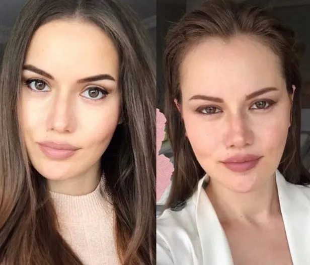 Fahriye Evcen�in yüzüne ne oldu? Hayranlarını şaşırtan fotoğraf Takvim