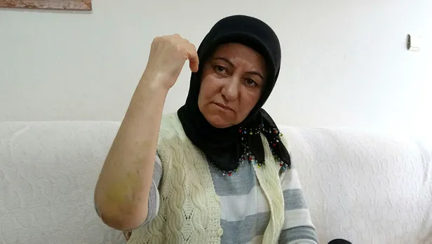 Sabiha Gökçen'de pistten çıkan Pegasus uçağındaki yolcu dehşet anlarını anlattı: "Ölenlerden birisi karşımda oturuyordu"-2