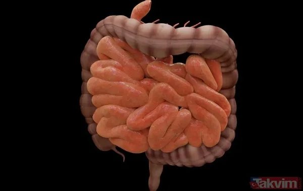 Geçmeyen Şişkinliği Normal Sanmayın! 33 Yaşındaki Genç Adamın 2 Yıl Geciken Bağırsak Kanseri Teşhisi - 3