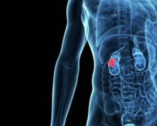 Her 8 kişiden biri...