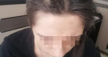 Konyada iki kadın tarafından kaçırılıp işkence edilen Demet A dehşet anlarını anlattı! Evden çıkamayacağım sandım