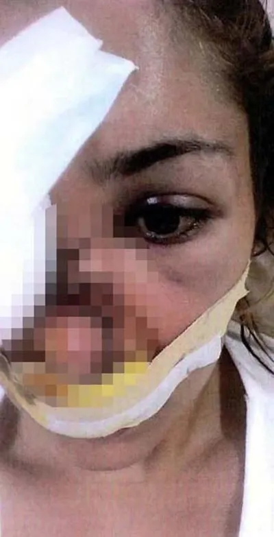 Tuğçe Aras A.'yı av tüfeğiyle vuran cani için istenen ceza belli oldu-4