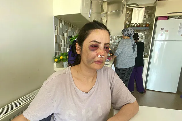 İstanbul'da kan donduran olay! Boşanmak isteyen eşine dehşeti yaşattı