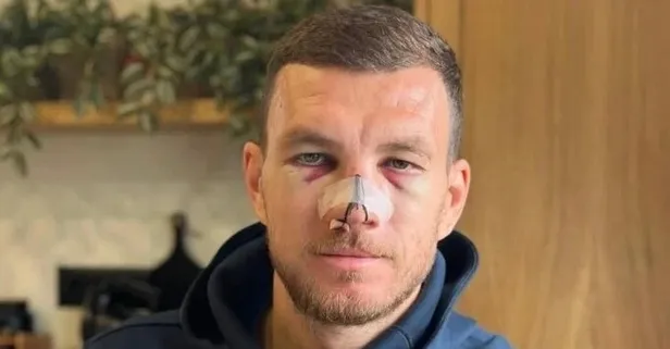 Edin Dzeko'dan sakatlık sonrası paylaşım