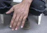 Yunan askerleri tarafından darp edilen mülteciler yaşadıklarını anlattı! "Ellerimde sigara söndürdüler"