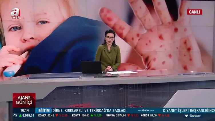 Sağlık Bakanı Fahrettin Koca'dan Suriyeli doktor ve kızamık vakaları iddialarına net yanıt