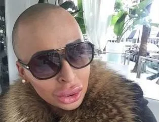 Kim Kardashian'a benzemek istedi!