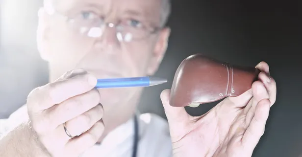 Karaciğer yağlanması nedir? Karaciğer yağlanması belirtileri nelerdir? Karaciğer yağlanması nasıl tedavi edilir?