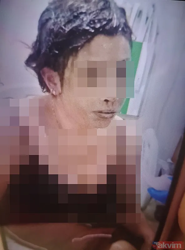 Gaziantep'te dehşet: Adem Külah eski eşini koli bandı ile bağlayıp başından aşağı kezzap döktü! - 2