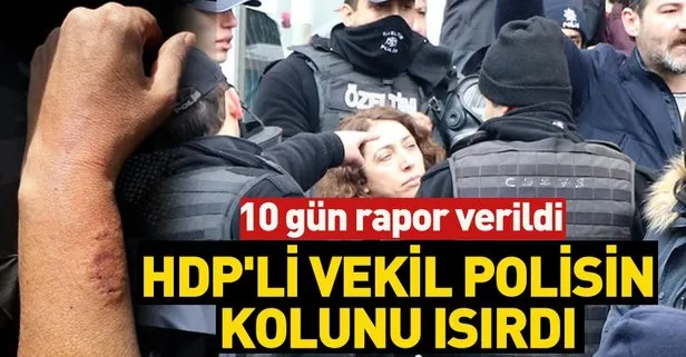 HDP’li vekil kadın polis memurunun kolunu ısırdı