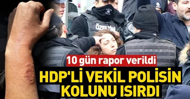 Hdp Li Vekil Kadin Polis Memurunun Kolunu Isirdi Takvim