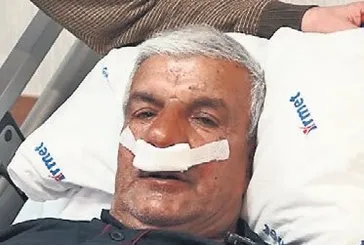 Burnundan taş çıktı: Burun tıkanıklığına dikkat!