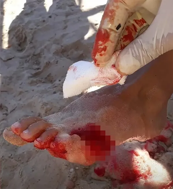 pirana-saldirisinda-4-kisi-oldu-paraguayda-piranalar-gundem-oldu-1641544268602.jpg Pirana saldırısında 4 kişi öldü! Paraguay'da piranalar gündem oldu-2