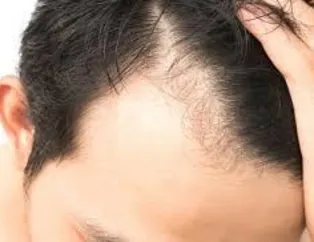 Seçimin sonucunu keller belirleyecek!