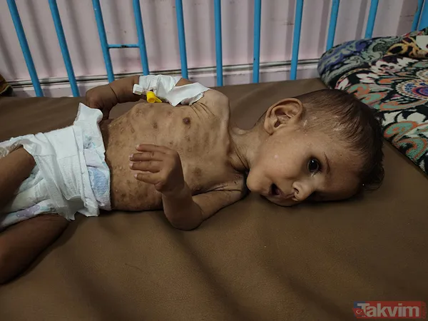 Gazze’de iki yıllık soykırım! On binlerce şehit, on binlerce yaralı: İsrail tüm kaynakları yok ediyor - 18