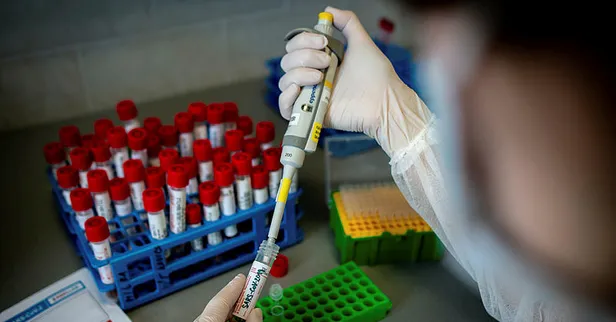 Son dakika: Bilim insanları ilk kez açıkladı! Koronavirüsle ilgili bildiğiniz her şeyi unutun! Corona virüs nerede ortaya çıktı?-12