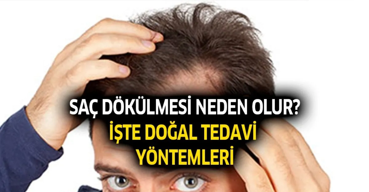 Genetik Sac Dokulmesi Hairneva