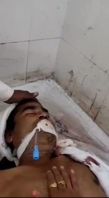 morgda-canlandi-kan-donduran-anlar-kamerada-iste-inanilmaz-anlar-1637758875535.jpg Morgda canlandı! Kan donduran anlar kamerada.... İşte inanılmaz anlar-5