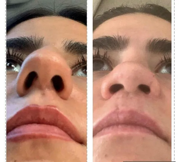 Son dakika: Ünlü estetisyen Op. Dr. Bilgehan Aydın'dan skandal olay! Burun operasyonu için kulağını kesti: Psikolojisi bozuldu-7