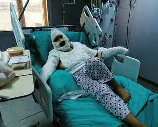 Böyle canilik görülmedi! Cezaevinden izinli çıktı eski eşini kızgın yağ ile yaktı
