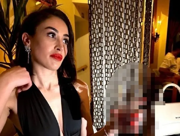 Ünlü fenomen Yeliz Açıkel'i göğüs büyütme ve dikleştirme için gittiği doktor darp etti!-8