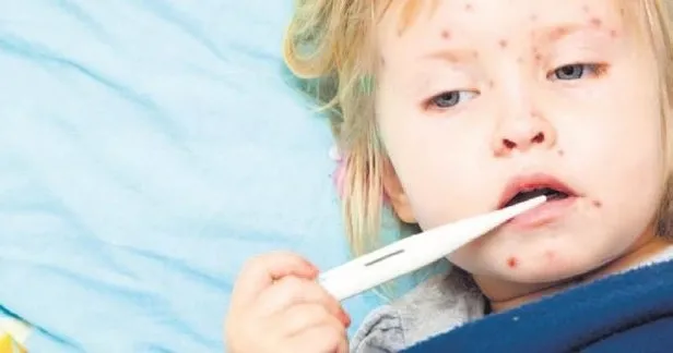 Son dakika: ABD ve İngiltere'den koronavirüs ile kawasaki hakkında korkutan açıklama: Bu belirtiler varsa hastaneye gidin-7